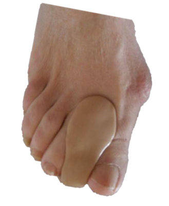 orthoplastie